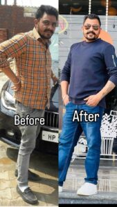 patient recovery images ( before and after )