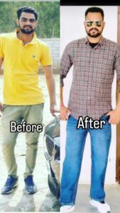 patient recovery images ( before and after )