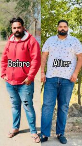 patient recovery images ( before and after )