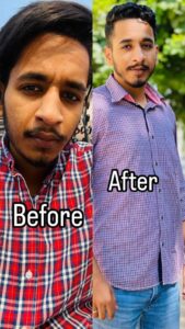 patient recovery images ( before and after )