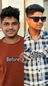 patient recovery images ( before and after )