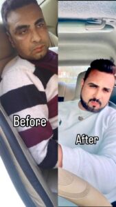 patient recovery images ( before and after )